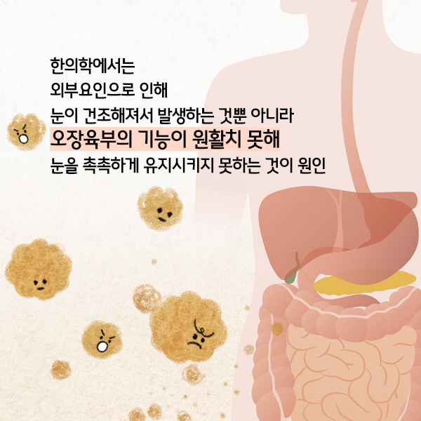 안구건조증2-6.jpg